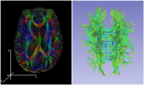 پردازش تصویر مغز
